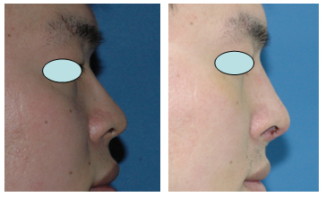 코성형클리닉 이미지