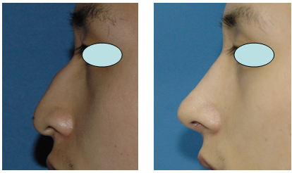 코성형클리닉 이미지