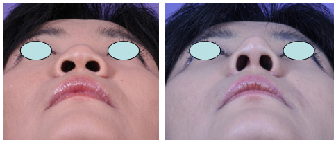 코성형클리닉 이미지